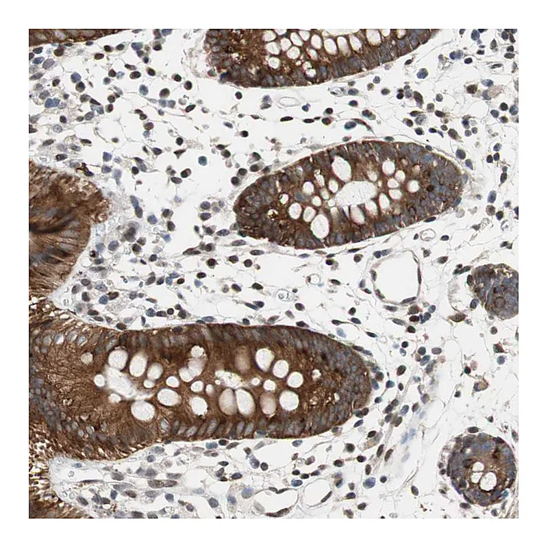 Atlas Antibodies Anti-ZNF512B Antibody