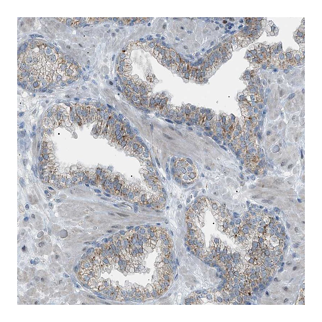 Atlas Antibodies Anti-ZNF516 Antibody