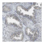 Atlas Antibodies Anti-ZNF516 Antibody