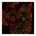 Atlas Antibodies Anti-ZNF517 Antibody