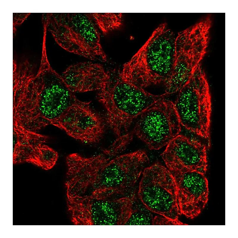 Atlas Antibodies Anti-ZNF517 Antibody