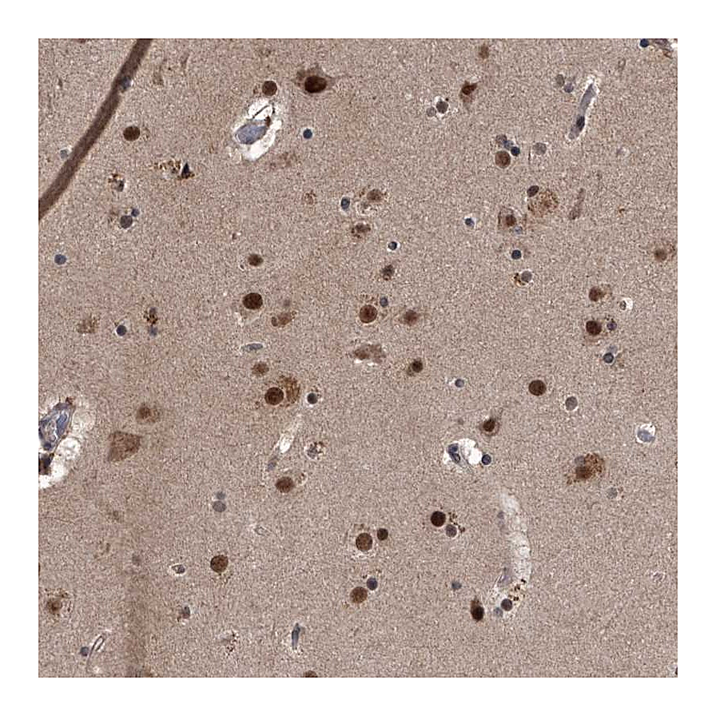 Atlas Antibodies Anti-ZNF518B Antibody
