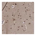 Atlas Antibodies Anti-ZNF518B Antibody