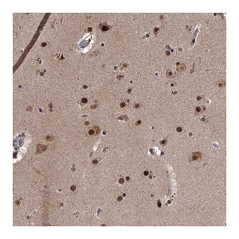 Atlas Antibodies Anti-ZNF518B Antibody