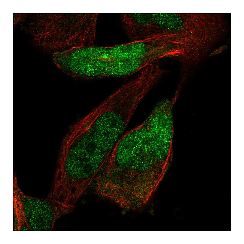 Atlas Antibodies Anti-ZNF518A Antibody