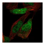 Atlas Antibodies Anti-ZNF518A Antibody