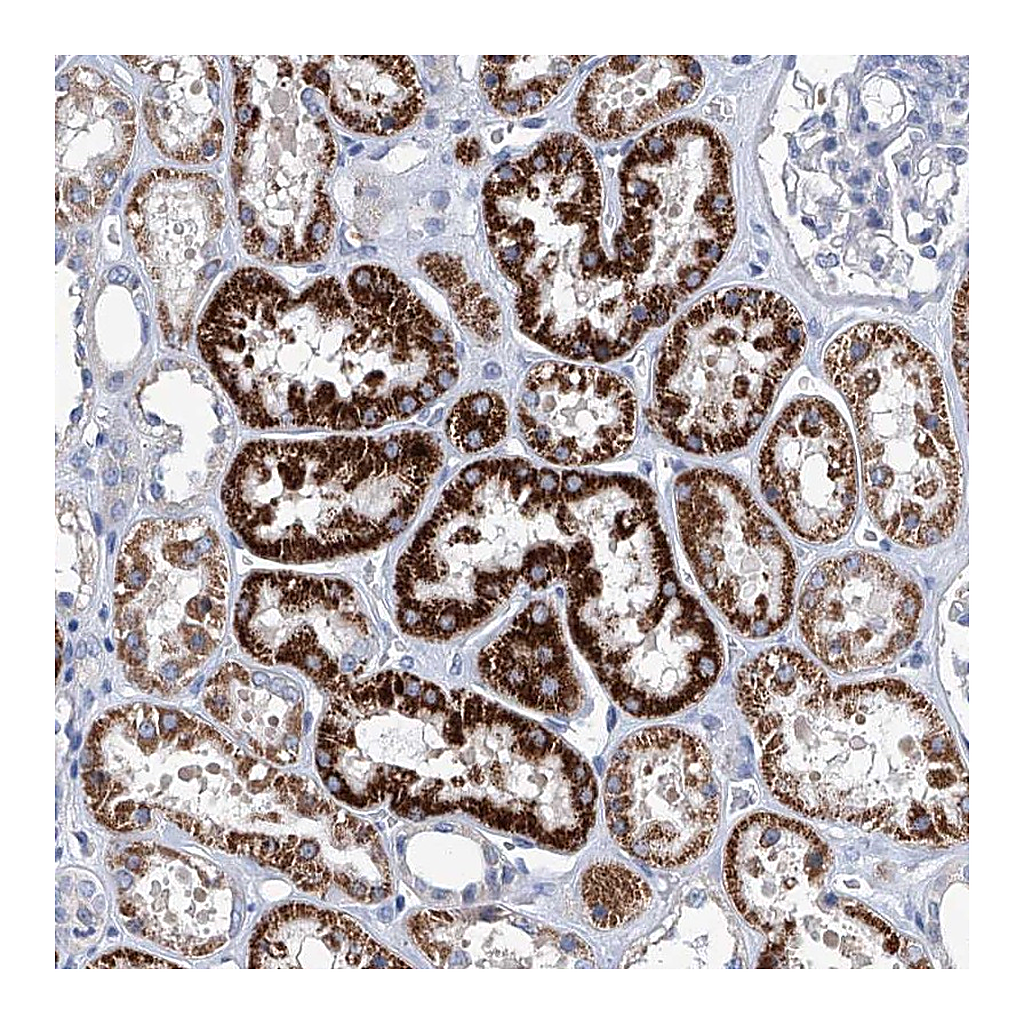 Atlas Antibodies Anti-ZNF519 Antibody