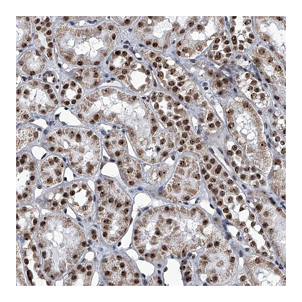 Atlas Antibodies Anti-ZNF518B Antibody