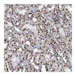 Atlas Antibodies Anti-ZNF518B Antibody