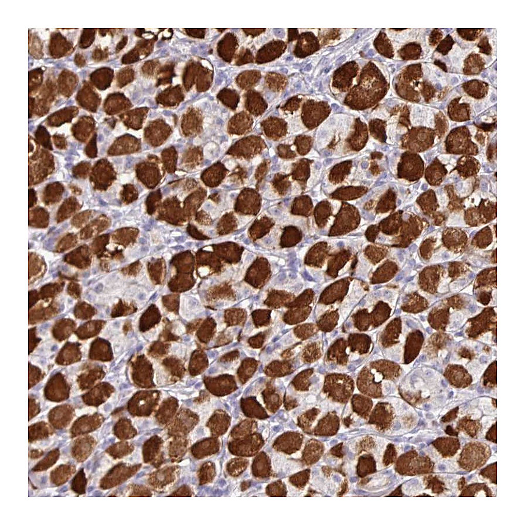 Atlas Antibodies Anti-ZNF524 Antibody