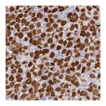 Atlas Antibodies Anti-ZNF524 Antibody