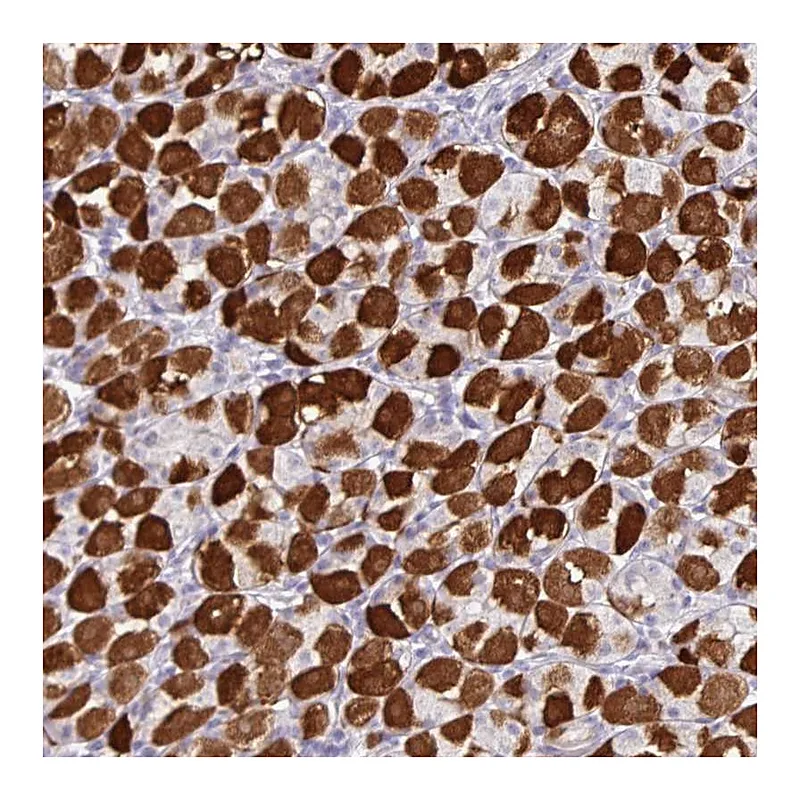 Atlas Antibodies Anti-ZNF524 Antibody