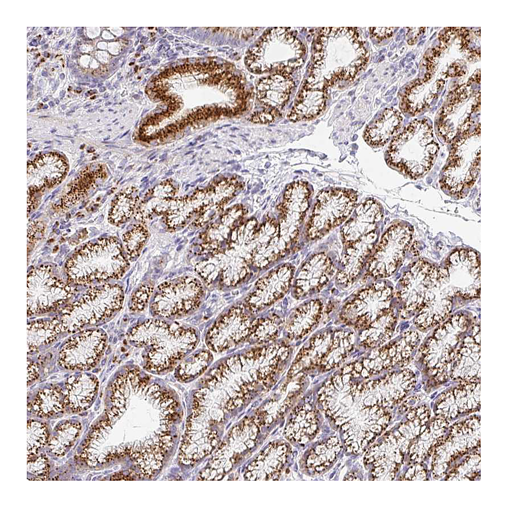 Atlas Antibodies Anti-ZNF526 Antibody