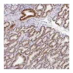 Atlas Antibodies Anti-ZNF526 Antibody