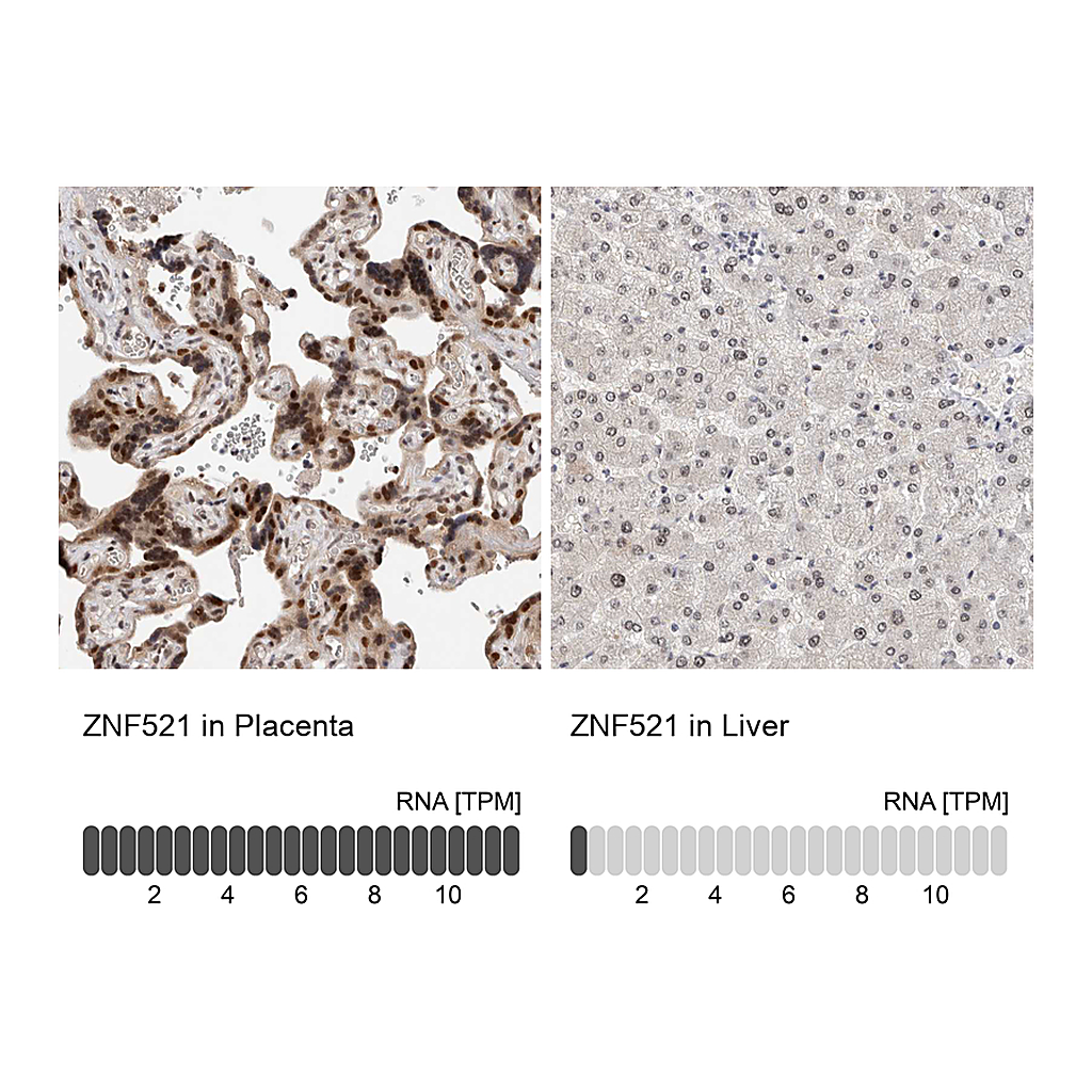 Atlas Antibodies Anti-ZNF521 Antibody