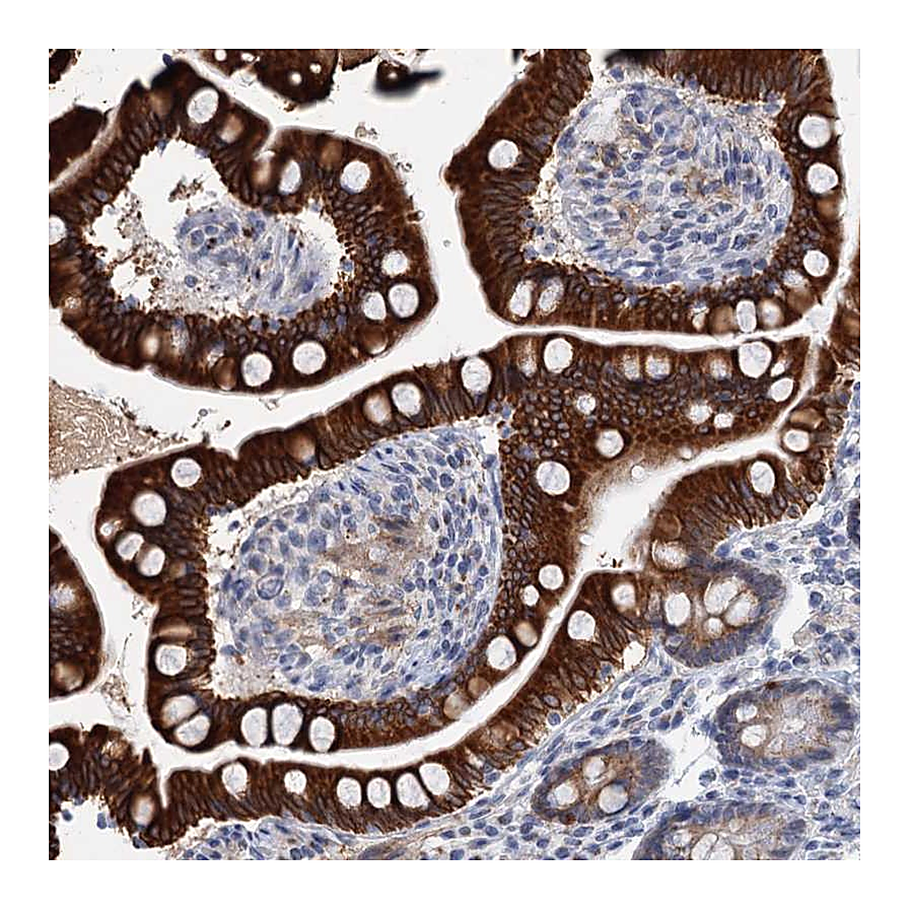 Atlas Antibodies Anti-ZNF527 Antibody