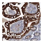 Atlas Antibodies Anti-ZNF527 Antibody