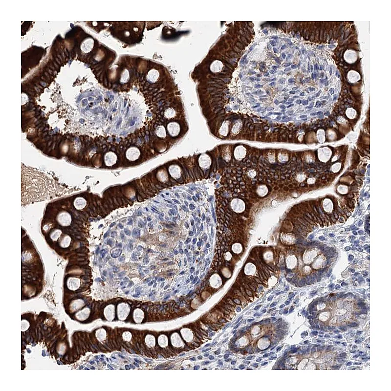 Atlas Antibodies Anti-ZNF527 Antibody