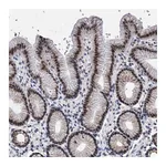 Atlas Antibodies Anti-ZNF529 Antibody