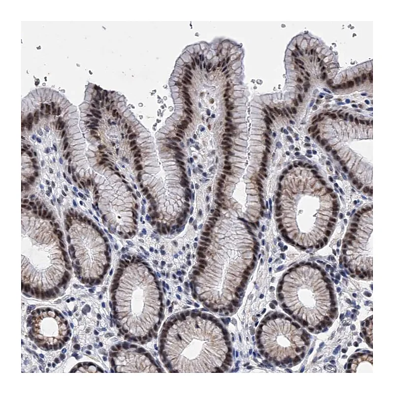 Atlas Antibodies Anti-ZNF529 Antibody