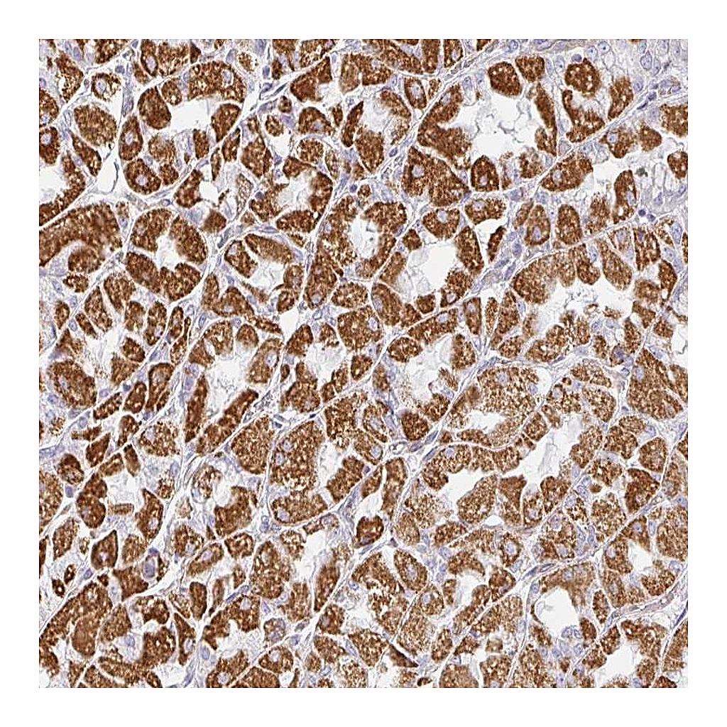 Atlas Antibodies Anti-ZNF526 Antibody