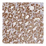 Atlas Antibodies Anti-ZNF526 Antibody