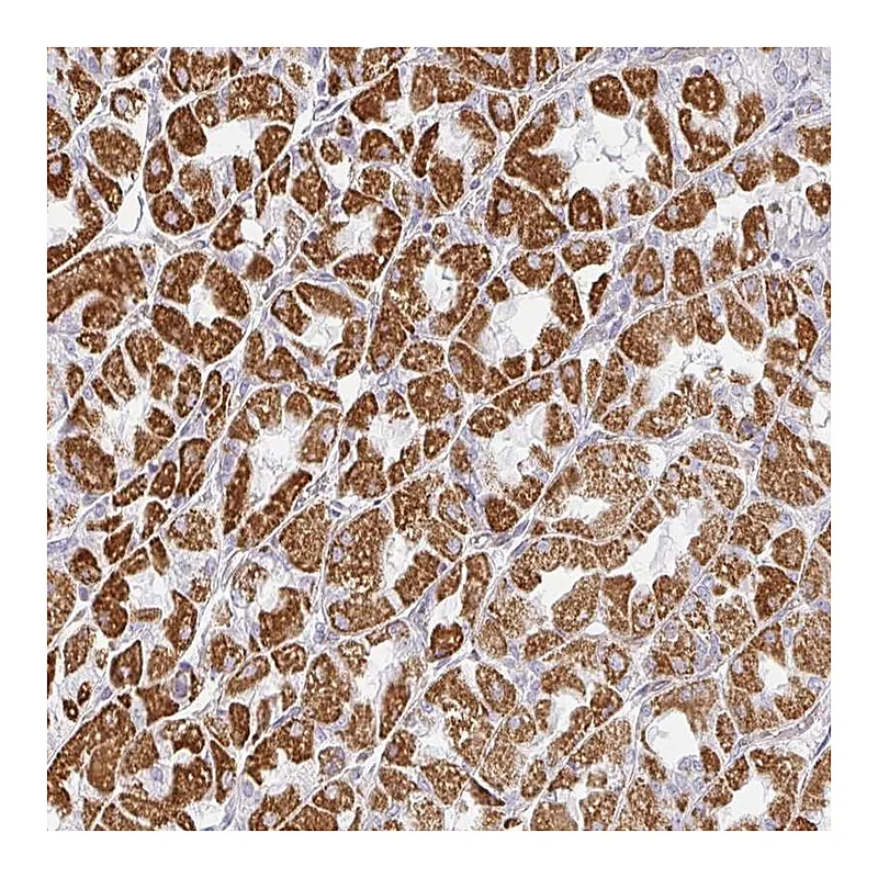 Atlas Antibodies Anti-ZNF526 Antibody