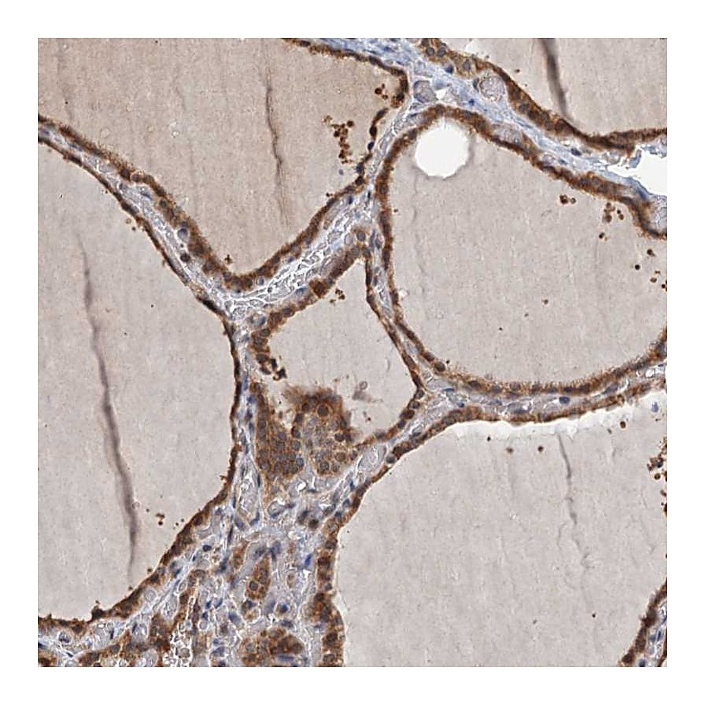 Atlas Antibodies Anti-ZNF527 Antibody