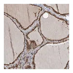 Atlas Antibodies Anti-ZNF527 Antibody