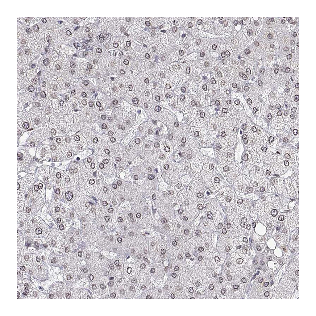 Atlas Antibodies Anti-ZNF532 Antibody