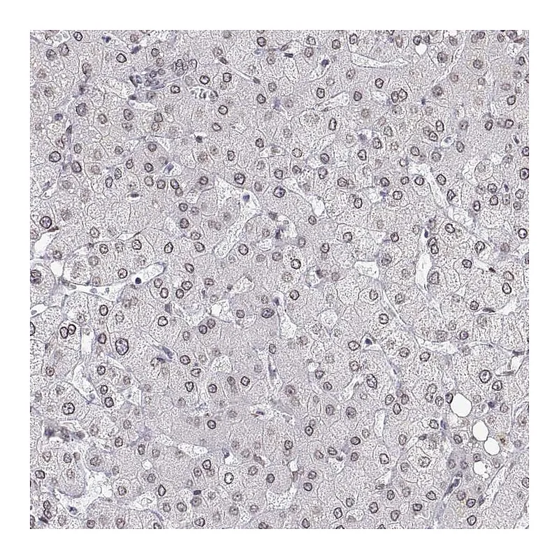 Atlas Antibodies Anti-ZNF532 Antibody