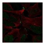Atlas Antibodies Anti-ZNF536 Antibody