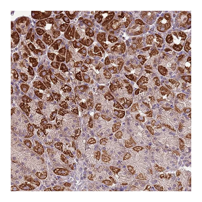Atlas Antibodies Anti-ZNF530 Antibody