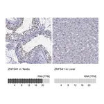 Atlas Antibodies Anti-ZNF541 Antibody