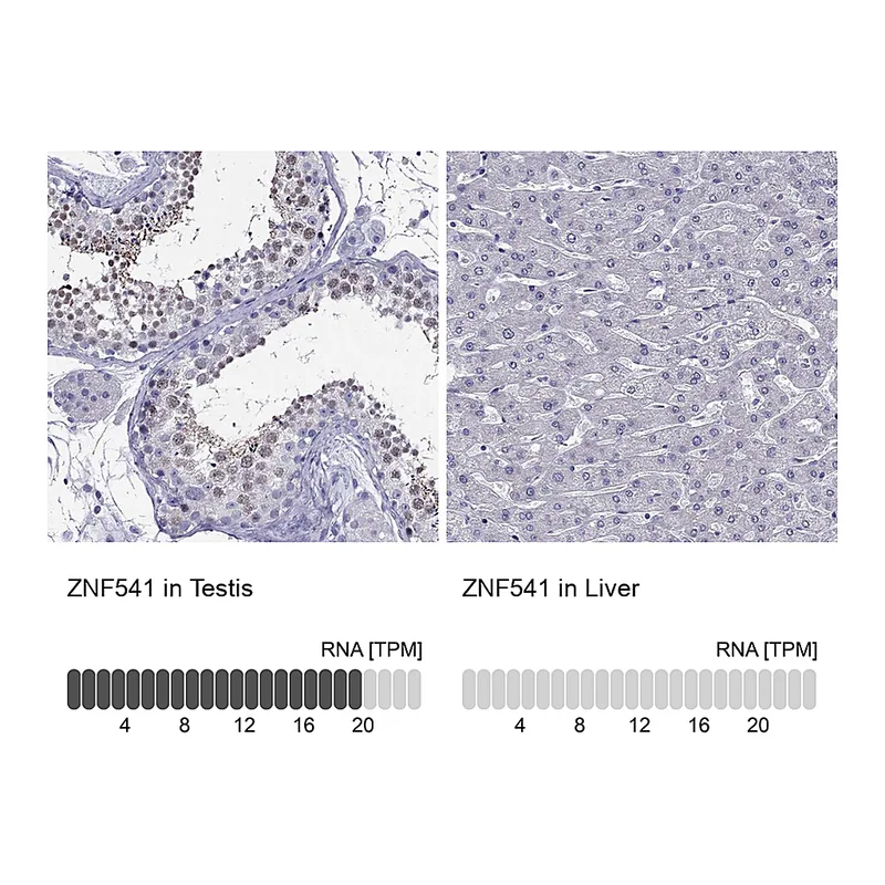 Atlas Antibodies Anti-ZNF541 Antibody