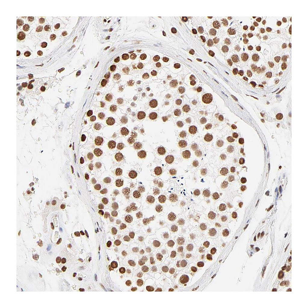 Atlas Antibodies Anti-ZNF540 Antibody