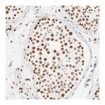 Atlas Antibodies Anti-ZNF540 Antibody