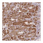 Atlas Antibodies Anti-ZNF547 Antibody