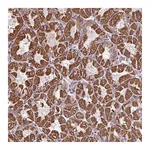 Atlas Antibodies Anti-ZNF548 Antibody