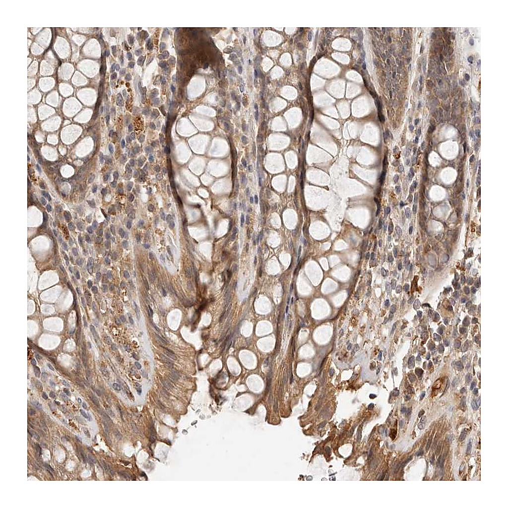 Atlas Antibodies Anti-ZNF543 Antibody