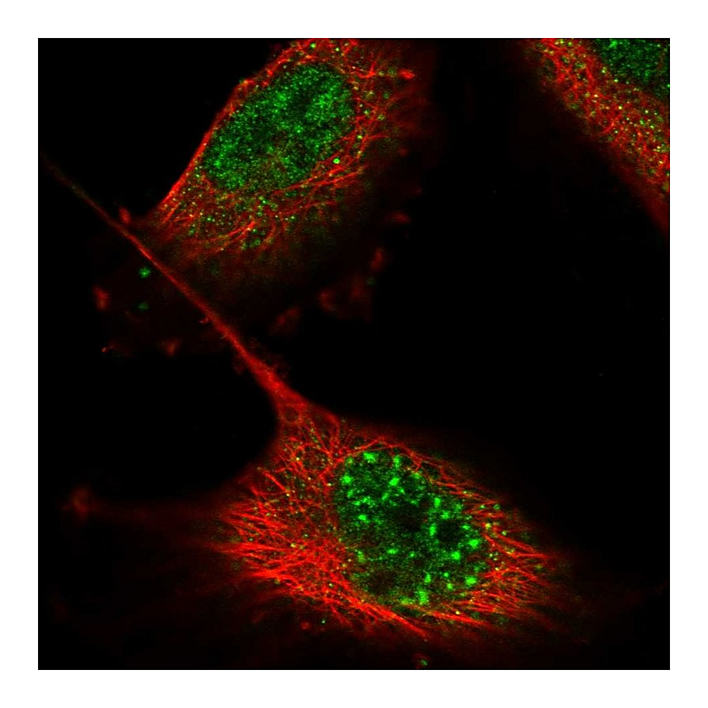Atlas Antibodies Anti-ZNF551 Antibody