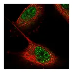 Atlas Antibodies Anti-ZNF551 Antibody