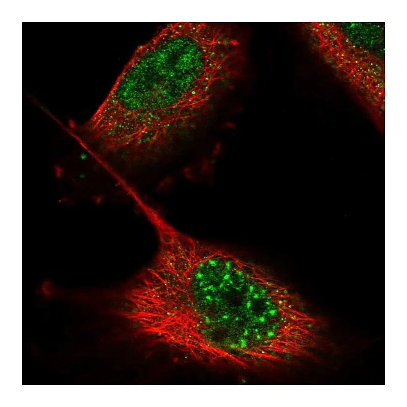 Atlas Antibodies Anti-ZNF551 Antibody