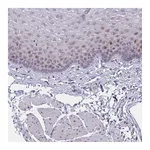 Atlas Antibodies Anti-ZNF554 Antibody