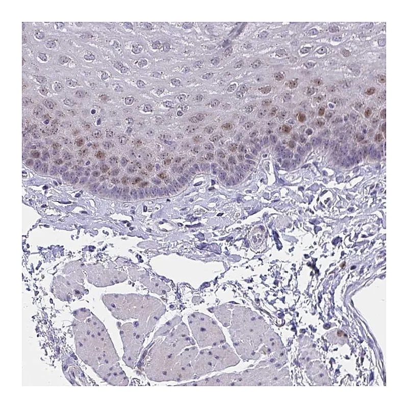 Atlas Antibodies Anti-ZNF554 Antibody