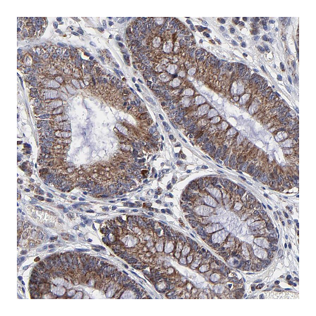 Atlas Antibodies Anti-ZNF550 Antibody