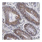 Atlas Antibodies Anti-ZNF550 Antibody