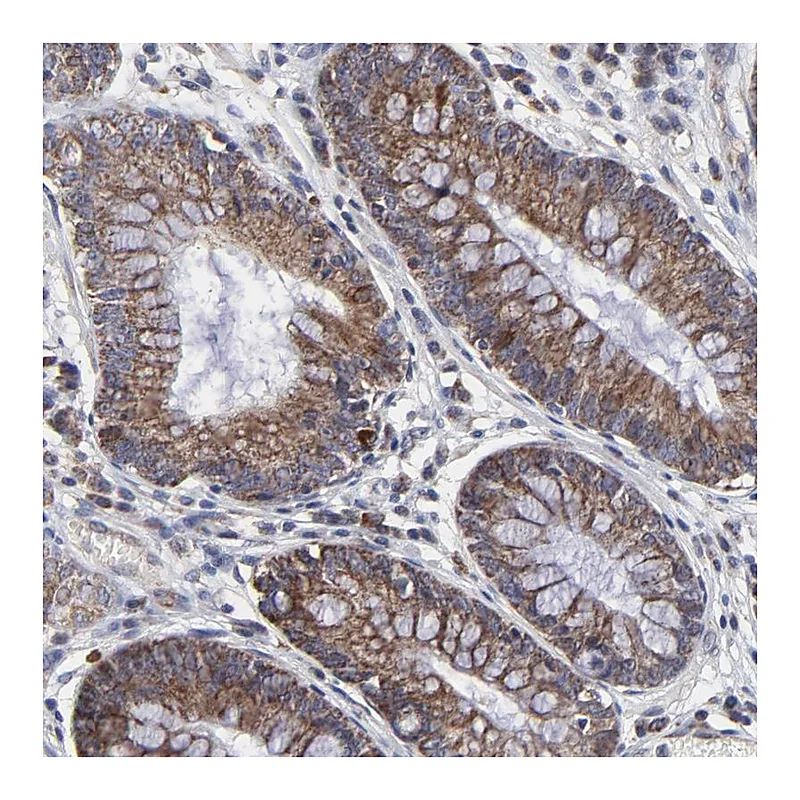 Atlas Antibodies Anti-ZNF550 Antibody
