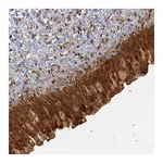 Atlas Antibodies Anti-ZNF549 Antibody