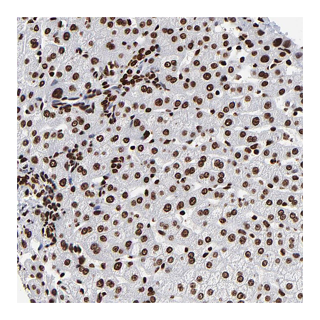 Atlas Antibodies Anti-ZNF544 Antibody